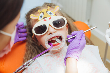dentist using a rubber dam while examining a patient. little girl with a cheek retractor in her...