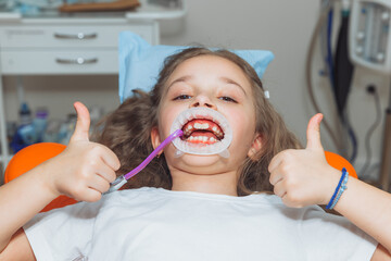 dentist using a rubber dam while examining a patient. little girl with a cheek retractor in her...