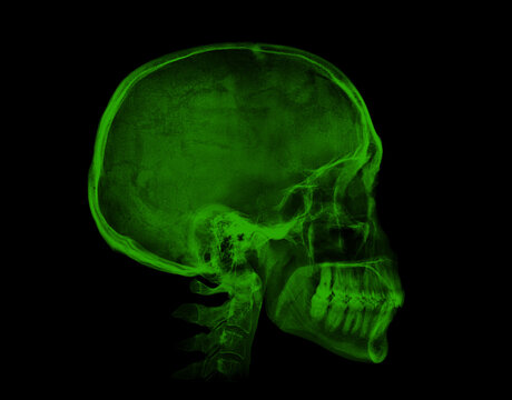 Human skull. Green X-ray image on black background