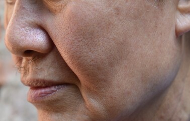 Obraz premium Enlarged pores in face of Asian, elder man with skin folds.