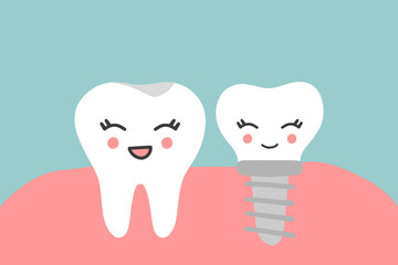 Cute dental characters. Teeth with dental implant cartoon in flat design. Tooth implant screw in gum.