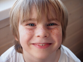 closeup portrait of teenage boy face with freckles