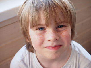 closeup portrait of teenage boy face with freckles