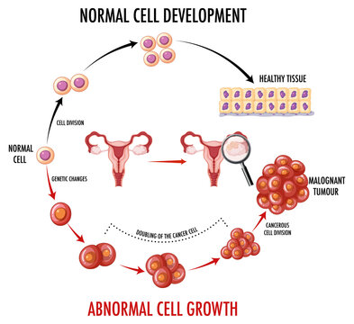 Diagram showing cancer development process