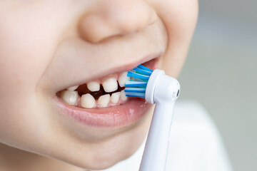 cute kid is brushing his teeth with an electric brush teeth. close up of child's mouth, rare teeth...