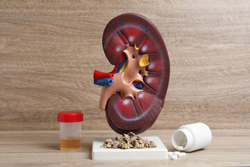 Kidney model with stones, urine sample and pills on wooden table