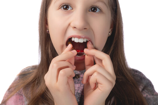 A cute little girl is putting on an orthodontic appliance. The concept of oral hygiene in childhood. Studio photo on a white background.