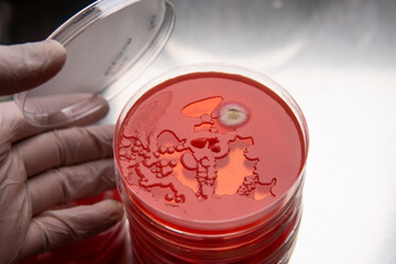 study of mold and bacteria in a petri dish with red agar. Mold spores and fungal mycelium