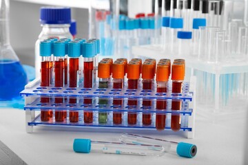 Analysis lab sample of new strain of Coronavirus Omicron.