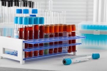 Analysis lab sample of new strain of Coronavirus Omicron.