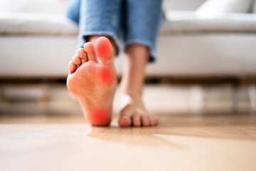 Foot Heel Pain And Callus Care Closeup