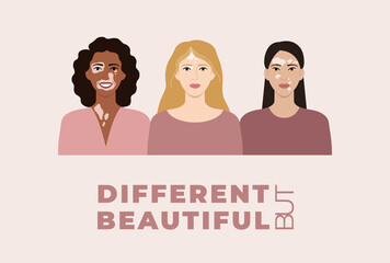 Female faces with vitiligo skin disease banner. Different but beautiful concept. Portraits with different ethnics, skin colors, hairstyles with vitiligo. Body positive, flat vector illustration