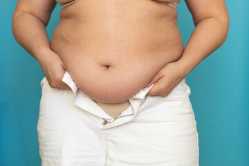 Cropped photo of fat plump obese plus-size overweight woman hold white unzipped shorts, showing...