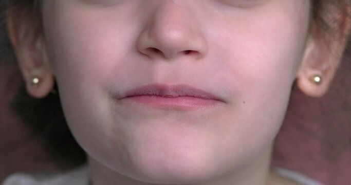 A young girl smiles and shows her crooked teeth. Mouth close-up.