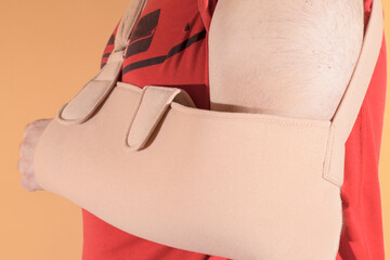 Man with his left arm in a sling after an operation to place a screw for a broken humerus.