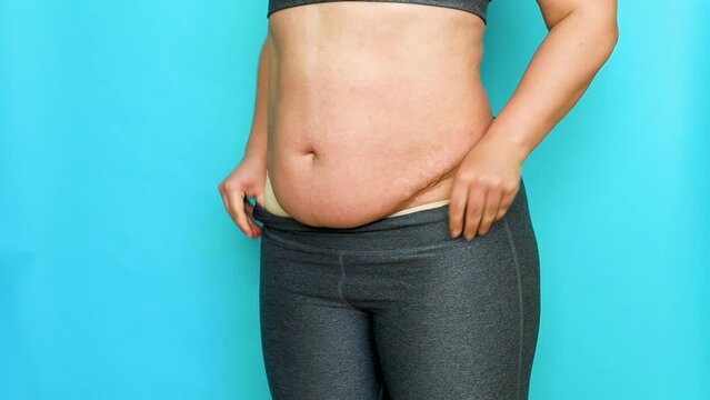 Unrecognizable fat plump overweight woman wearing beige underwear, grey sports top, pulling on leggings, hiding excess stomach on blue background. Body positive, obesity, weight loss, liposuction.