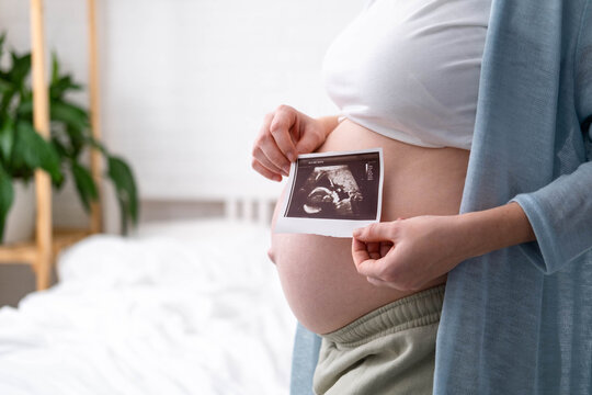 Top view cropped of pregnant woman with ultrasound photo of fetus standing at home, young future mom waiting child first baby, pregnancy and motherhood concept