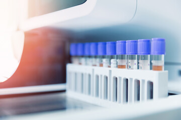 Banner medical blood tests on automatic modern equipment