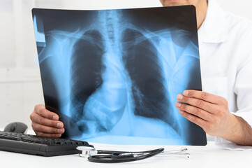 Man Doctor Looking at X-Ray Radiography in patient's Room with lung disease, long COVID-19 at...