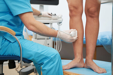 Phlebologist examining the condition of leg veins with an ultrasound machine - obrazy, fototapety, plakaty