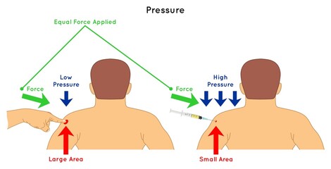 Pressure Infographic Diagram example of touching shoulder by index finger and injection equal force result in low pressure for large area high pressure for small area physics science education vector