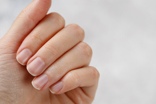 Closeup healthy natural woman's nails without nail polish. Remove gel polish.