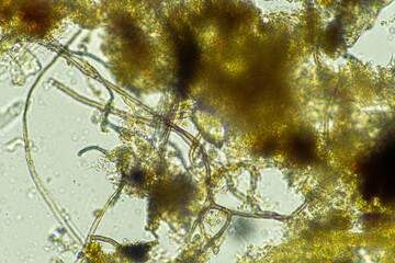 biological organisms under the microscopes in australia. living microorganisms