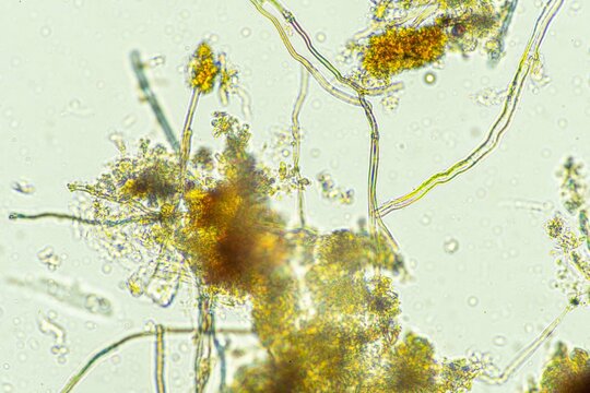 biological organisms under the microscopes in australia. living microorganisms