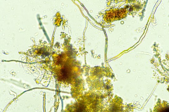 biological organisms under the microscopes in australia. living microorganisms