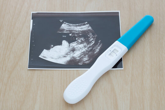 Pregnancy test showing a positive result and ultrasound picture of baby isolated on wooden background. Result of ultrasound picture or ultrasonography for pregnancy. Pregnancy care concept.