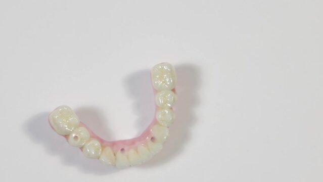 Dental health care. Close up ceramic zirconium. Dental prosthesis on zirconium oxide implants