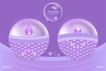 Hyaluronic acid before and after skin solutions ad, purple collagen serum drops over skin cells with cosmetic advertising background ready to use, illustration vector.