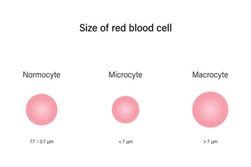 Red blood cell morphology. Size of red blood cell. Anisocytosis.