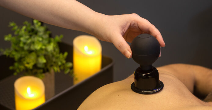 Tratamiento de masaje con ventosas sobre la espalda de un hombre joven