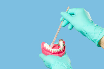 Dentist's hands in gloves with saliva ejector and human jaw layout.