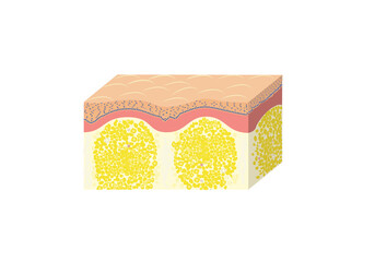 cellulite scheme, histology, vector