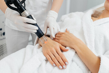 A young girl gets carbon peeling for the skin of her hands in a beauty salon. Laser pulses cleanse the skin. Hardware cosmetology. The process of photothermolysis, warming the skin.