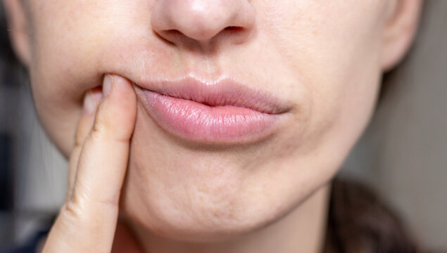 Lips massage techniques, home practicing.Young woman, adult, doing facial massage, face yoga. rejuvenation, anti aging, lifting, anti wrinkle exercises face building for skin and muscles.gymnastics