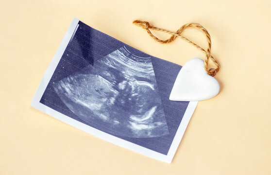 ultrasound picture and a white ceramic heart on light orange background. sonogram of fetus, unborn yet baby, flat lay, love care family