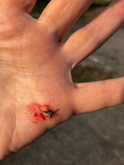 Blood on hands from smashed mosquito