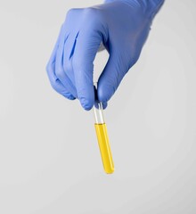 A hand in a blue glove holds a test tube with a yellow liquid. Medical or scientific research, new vaccination