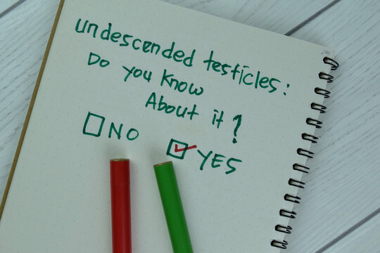 Concept of Yes, Undescended Testicles: Do you know about it? write on a book isolated on Wooden Table.