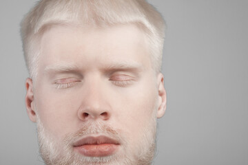 Albinism, abnormal deviations concept. Unusual bearded albino man posing with closed eyes, grey background, copy space - obrazy, fototapety, plakaty