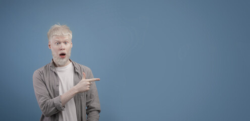 Promotion concept. Young surprised albino guy pointing aside at copy space and looking at camera with open mouth
