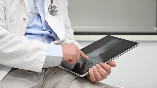 Unrecognizable Doctor is checking x-ray image at computer tablet, close up. Doctor at work in a hospital. Medicine and healthcare concept. High quality 4k footage