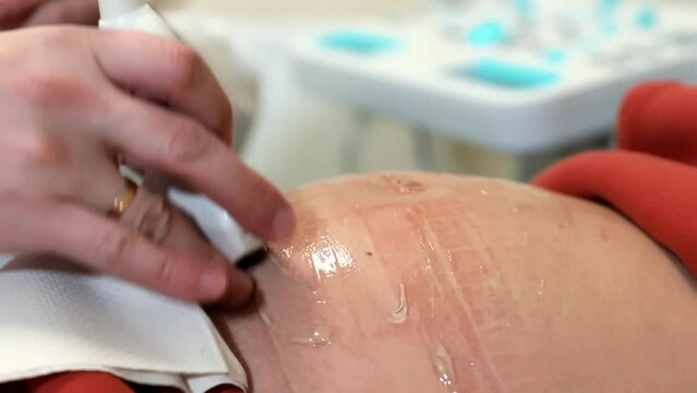Preparation for ultrasound of the pelvic organs during pregnancy. Obstetric ultrasound. Ultrasound examination of a pregnant woman.