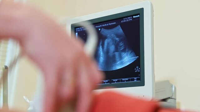 Ultrasound of the pelvic organs during pregnancy. Obstetric ultrasound. Ultrasound echamination of a pregnant woman
