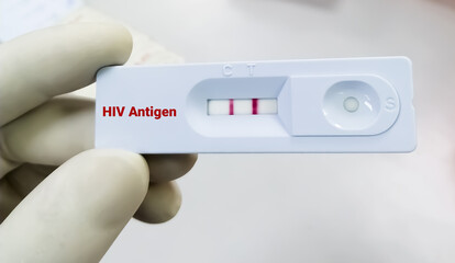 Rapid test cassette for HIV antigen, AIDS - obrazy, fototapety, plakaty