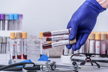 Suspected adenovirus as a culprit in childhood hepatitis of unknown origin. Hepatic, sars-cov2.