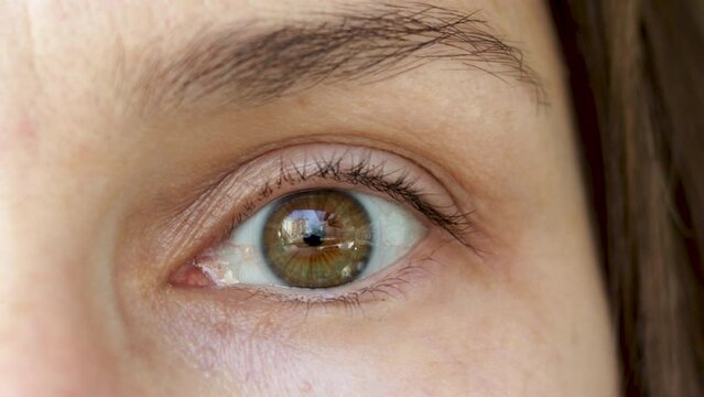 myopia, contact lens. young girl's eye blinking and looking at the camera or up. sky and buildings reflection in woman's eye. no make up, natural brow, no mascara or foundation, eye shadows.